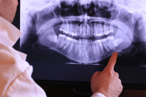 Best Emergency Treatment for Dental Infections or Abscesses in South Lake Tahoe, CA